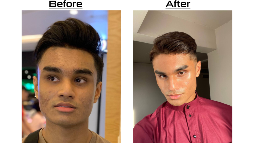 Before and after of Naz